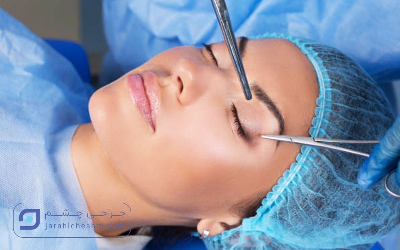 آمادگی بیمار در حین عمل جراحی زیبایی پلک یا بلفاروپلاستی