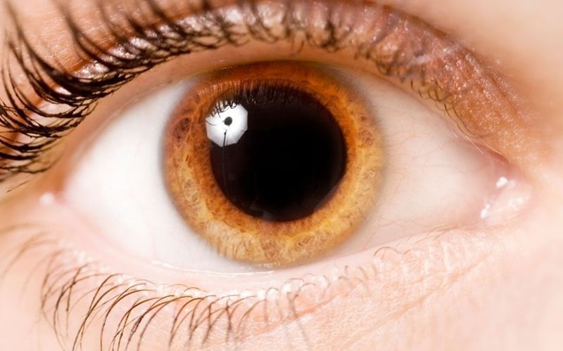 انواع رینگ داخل چشمی